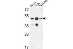 Western Blotting (WB) image for anti-Sphingomyelin Synthase 2 (SGMS2) antibody (ABIN3004329) (Sphingomyelin Synthase 2 Antikörper)