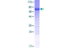 Image no. 1 for EP400 N-Terminal Like (EP400NL) (AA 1-419) protein (GST tag) (ABIN1352869) (EP400NL Protein (AA 1-419) (GST tag))