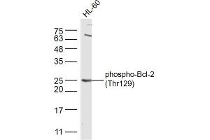 HL-60 cell line lysates probed with Bcl-2 (Thr129) Polyclonal Antibody, Unconjugated  at 1:300 dilution and 4˚C overnight incubation. (Bcl-2 Antikörper  (pThr129))