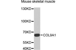 Western blot analysis of extracts of mouse skeletal muscle, using COL9A1 antibody (ABIN5975036) at 1/1000 dilution. (COL9A1 Antikörper)
