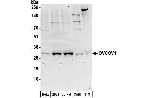anti-Ovarian Cancer Overexpressed 1 (OVCOV1) (AA 315-365) antibody