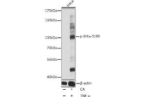 Western blot analysis of extracts of HeLa cells, using Phospho-IKKα-S180 antibody (ABIN6135203, ABIN6136048, ABIN6136049 and ABIN6225542) at 1:1000 dilution. (IKK alpha Antikörper  (pSer180))