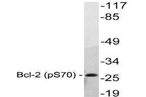 Image no. 1 for anti-B-Cell CLL/lymphoma 2 (BCL2) (pSer70) antibody (ABIN317971) (Bcl-2 Antikörper  (pSer70))