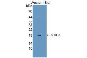 Western blot analysis of the recombinant protein. (UBA52 Antikörper  (AA 1-128))