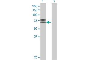 Western Blot analysis of IL2RB expression in transfected 293T cell line by IL2RB MaxPab polyclonal antibody. (IL2 Receptor beta Antikörper  (AA 1-551))