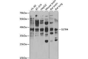 Western blot analysis of extracts of various cell lines, using SSTR4 antibody (ABIN6129726, ABIN6148502, ABIN6148503 and ABIN6222751) at 1:1000 dilution. (SSTR4 Antikörper  (AA 314-388))