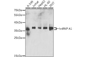 Western blot analysis of extracts of various cell lines, using hnRNP  antibody (ABIN6128029, ABIN6141896, ABIN6141899 and ABIN6223388) at 1:200 dilution. (HNRNPA1 Antikörper  (AA 1-372))