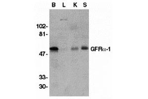 Western Blotting (WB) image for anti-GDNF Family Receptor alpha 1 (GFRA1) (Middle Region) antibody (ABIN1030937)