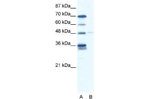 WB Suggested Anti-GLIS2 Antibody Titration: 2. (GLIS2 Antikörper  (N-Term))