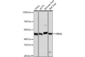 Western blot analysis of extracts of various cell lines, using RRM2 Rabbit mAb (ABIN7269989) at 1:1000 dilution. (RRM2 Antikörper)