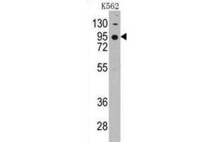 Western Blotting (WB) image for anti-Cadherin 7 (CDH7) antibody (ABIN2998181) (Cadherin 7 Antikörper)