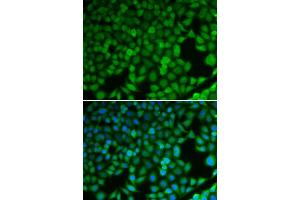 Immunofluorescence analysis of U2OS cells using NDRG1 antibody. (NDRG1 Antikörper  (AA 175-394))