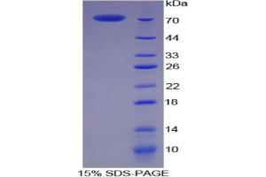 SDS-PAGE analysis of Pig CKM Protein. (CKM Protein)