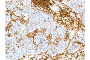 Immunohistochemistry (IHC) image for anti-CD38 (AA 43-300) antibody (ABIN7453961) (Rekombinanter CD38 Antikörper  (AA 43-300))