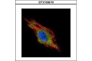 Image no. 2 for anti-Charged Multivesicular Body Protein 2B (CHMP2B) (AA 1-213) antibody (ABIN1497503)