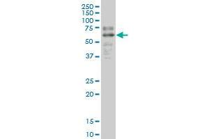 SOX9 monoclonal antibody (M04), clone 3F11 Western Blot analysis of SOX9 expression in HepG2 .