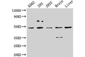 Western Blot Positive WB detected in: K562 whole cell lysate, 293 whole cell lysate, 293T whole cell lysate, Rat brain tissue, Mouse liver tissue All lanes: CSNK1D antibody at 5 μg/mL Secondary Goat polyclonal to rabbit IgG at 1/50000 dilution Predicted band size: 48, 47 kDa Observed band size: 48 kDa (Casein Kinase 1 delta Antikörper  (Isoform delta))