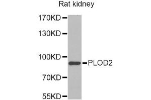 Western blot analysis of extracts of rat kidney, using PLOD2 Antibody (ABIN2564587) at 1:1000 dilution. (PLOD2 Antikörper)