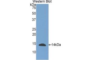 Western blot analysis of the recombinant protein. (INHBE Antikörper  (AA 237-350))