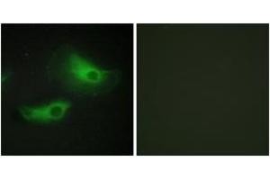Immunofluorescence (IF) image for anti-Adducin 2 (Beta) (ADD2) (AA 471-520) antibody (ABIN2889855) (ADD2 Antikörper  (AA 471-520))