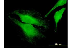 Immunofluorescence of monoclonal antibody to FARP1 on HeLa cell. (FARP1 Antikörper  (AA 471-549))