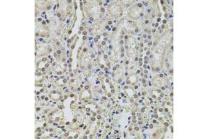 Immunohistochemistry of paraffin-embedded rat kidney using SMARCC2 antibody. (SMARCC2 Antikörper)