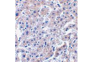 Immunohistochemistry of CASP14 in human liver tissue with CASP14 polyclonal antibody  at 2.