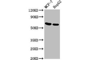 Western Blot Positive WB detected in: MCF-7 whole cell lysate, HepG2 whole cell lysate All lanes: GNAS antibody at 3. (GNAS Antikörper  (AA 310-404))