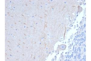 Formalin-fixed, paraffin-embedded human Brain stained with ATG5 Mouse Monoclonal Antibody (ATG5/2101). (ATG5 Antikörper  (AA 1-119))
