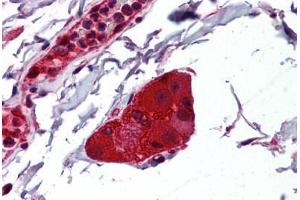 Human Small Intestine, Submucosal Plexus: Formalin-Fixed, Paraffin-Embedded (FFPE) (NDRG1 Antikörper  (AA 1-395))