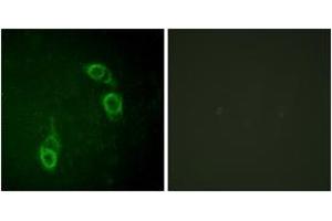 Immunofluorescence analysis of HepG2 cells, using APC1 (Ab-688) Antibody.