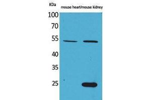 Western Blotting (WB) image for anti-Secretogranin III (SCG3) (N-Term) antibody (ABIN3178173) (SCG3 Antikörper  (N-Term))