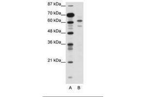 Image no. 1 for anti-Zinc Finger and SCAN Domain Containing 2 (ZSCAN2) (N-Term) antibody (ABIN6736118) (ZSCAN2 Antikörper  (N-Term))