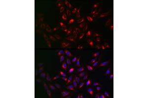 Immunofluorescence analysis of U2OS cells using VAPB Rabbit pAb (ABIN6132783, ABIN6150058, ABIN6150059 and ABIN6221003) at dilution of 1:100 (40x lens).
