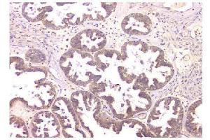 IHC analysis of WWOX using anti-WWOX antibody (ABIN6719627). (WWOX Antikörper  (AA 1-245))