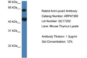 Western Blotting (WB) image for anti-Lysophosphatidylcholine Acyltransferase 2 (LPCAT2) (N-Term) antibody (ABIN2782922) (LPCAT2 Antikörper  (N-Term))