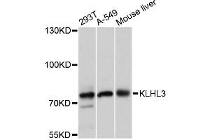Western blot analysis of extracts of various cell lines, using KLHL3 antibody (ABIN6293045) at 1:3000 dilution. (KLHL3 Antikörper)