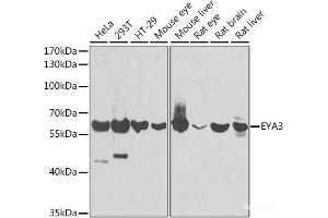 Western blot analysis of extracts of various cell lines using EYA3 Polyclonal Antibody at dilution of 1:1000. (EYA3 Antikörper)