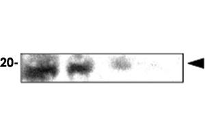 Immunoblot analysis of rat eye extracts were resolved by electrophoresis , transferred to PVDF membrane and probed with CRYAA monoclonal antibody , clone c9F2 (1 : 1000)  . (CRYAA Antikörper  (AA 1-173))
