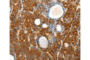 Immunohistochemistry (IHC) image for anti-Secretin Receptor (SCTR) antibody (ABIN1874706) (SCTR Antikörper)