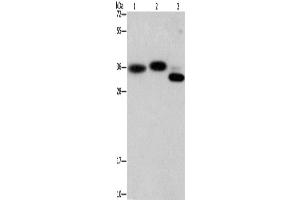 Western Blotting (WB) image for anti-Capping Protein (Actin Filament) Muscle Z-Line, alpha 2 (CAPZA2) antibody (ABIN2423050)