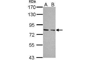 WB Image Sample (30 ug of whole cell lysate) A: JC B: BCL-1 7. (PRKG1 Antikörper  (Center))