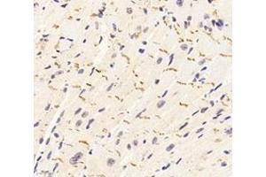Immunohistochemistry analysis of paraffin-embedded mouse heart using,DSP (ABIN7073719) at dilution of 1: 1000