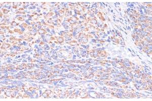 Immunohistochemistry of paraffin-embedded Rat ovary using COX5A Polyclonal Antibody at dilution of 1:100 (40x lens). (COX5A Antikörper)