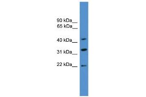 WB Suggested Anti-ARFIP1 Antibody Titration: 0.