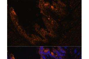 Immunofluorescence analysis of Mouse bronchus cells using KRT7 Polyclonal Antibody at dilution of 1:100. (Cytokeratin 7 Antikörper)