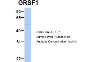 Western Blotting (WB) image for anti-G-Rich RNA Sequence Binding Factor 1 (GRSF1) (Middle Region) antibody (ABIN2778788)