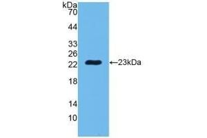 Detection of Recombinant PGLYRP1, Human using Polyclonal Antibody to Peptidoglycan Recognition Protein 1 (PGLYRP1) (PGLYRP1 Antikörper  (AA 22-196))