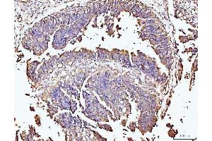 IHC analysis of DUSP6 using anti-DUSP6 antibody (ABIN7599332).