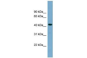 WB Suggested Anti-CDCA7L Antibody Titration: 0. (CDCA7L Antikörper  (Middle Region))
